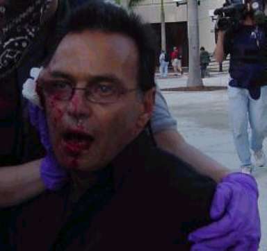 head injury1 crop.jpg
