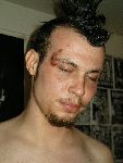 tom injury.jpg